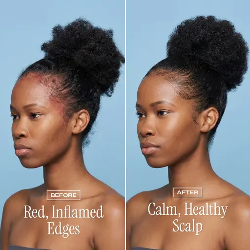 NightDew Scalp Repair Serum