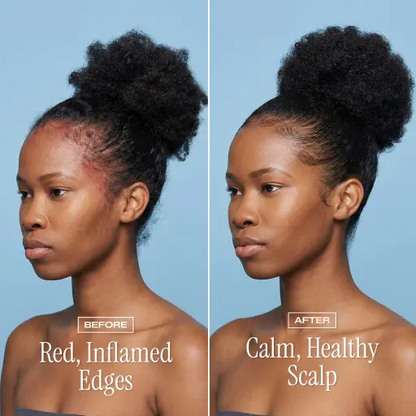 NightDew Scalp Repair Serum