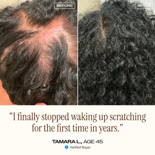 NightDew Scalp Repair Serum