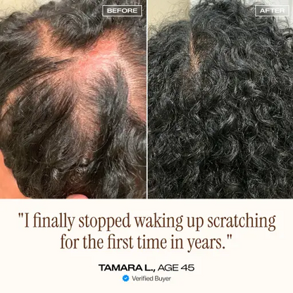 NightDew Scalp Repair Serum