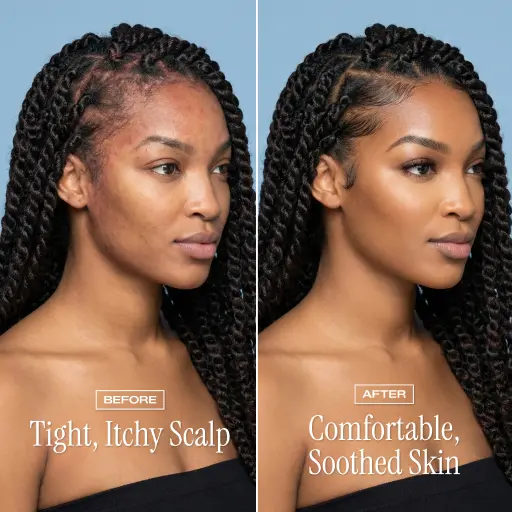 NightDew Scalp Repair Serum