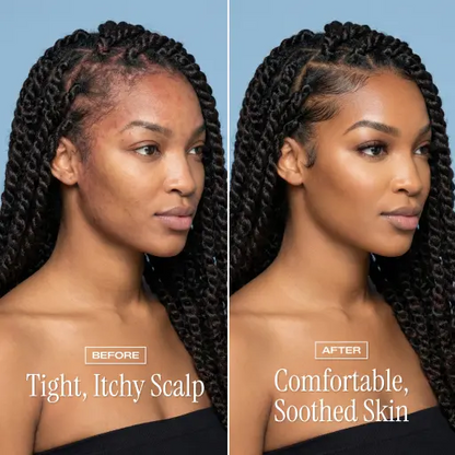 NightDew Scalp Repair Serum