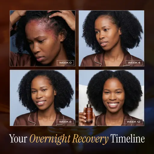 NightDew Scalp Repair Serum